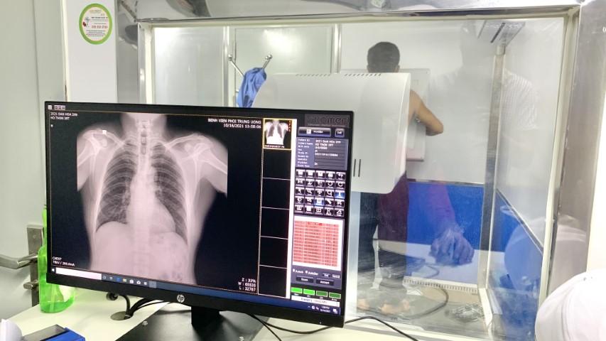 Chụp X Quang cho người dân trên xe X Quang kỹ thuật số lưu động. 2