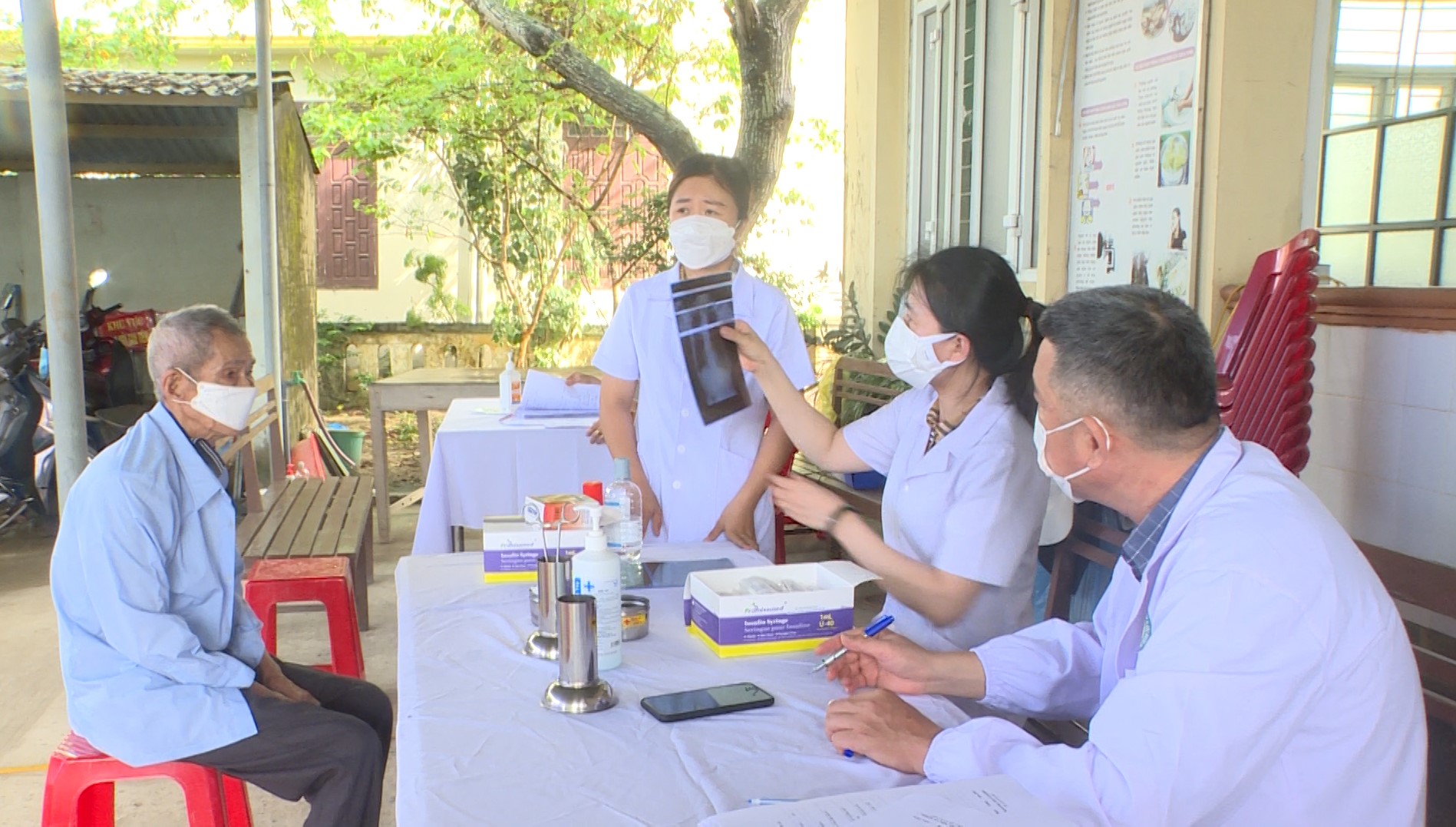 Trong quá trình sàng lọc người dân được khám chụp X Quang phổi phát hiện lao bệnh phổi và các biến chứng hậu covid 19jpg